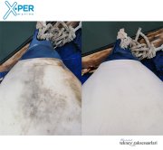 XPER Usturmaça ve Bot Temizleyici, FENDER AND BOAT CLEANER